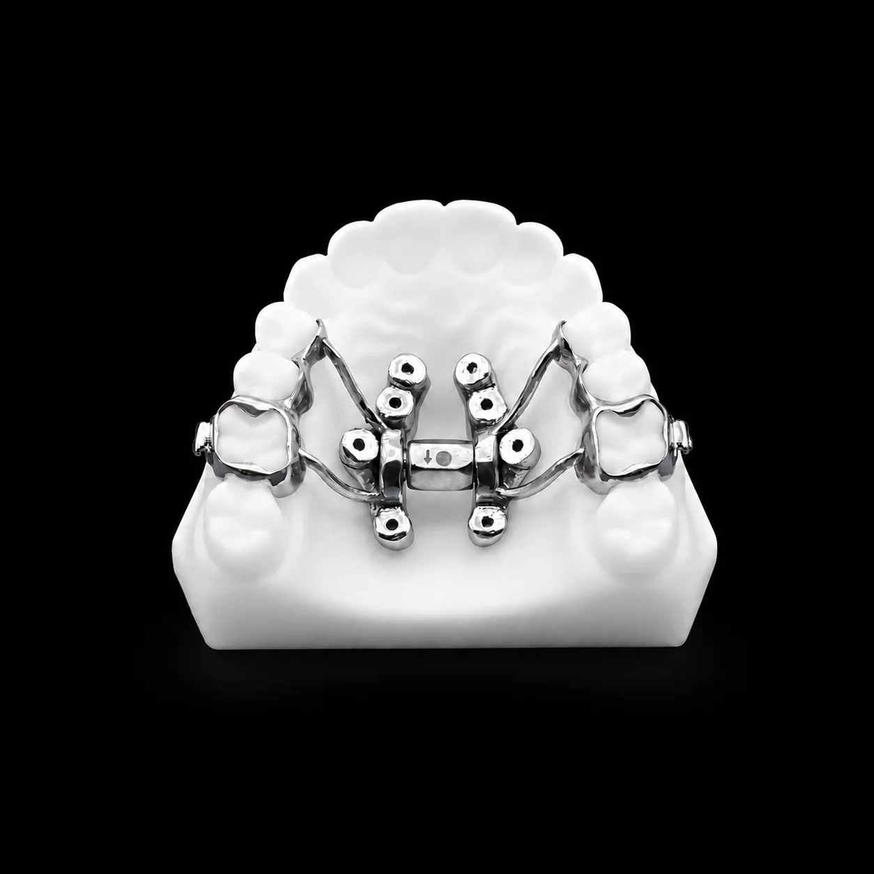 MARPE treatment appliance